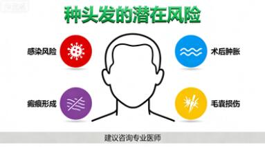 种头发有什么风险以及副作用吗?这些真相你必须知道!