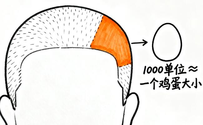 1000单位植发面积真相：巴掌大的“头顶革命”藏着多少秘密？