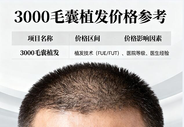 种植3000毛囊价格全解析:从2万到10万,如何选对技术不花冤枉钱?