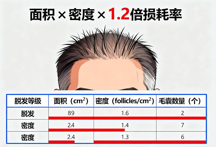 植发密度越高越好吗？如何精准判断所需毛囊数量？2026年科学指南