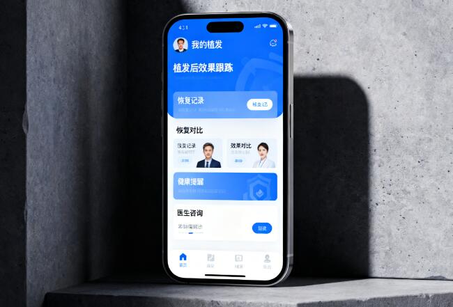 植发后效果跟踪APP：数据记录如何成为你的“术后护理神器”？