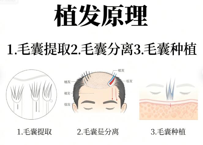 植发后效果科普文章可信度解析:如何找到权威信息源?