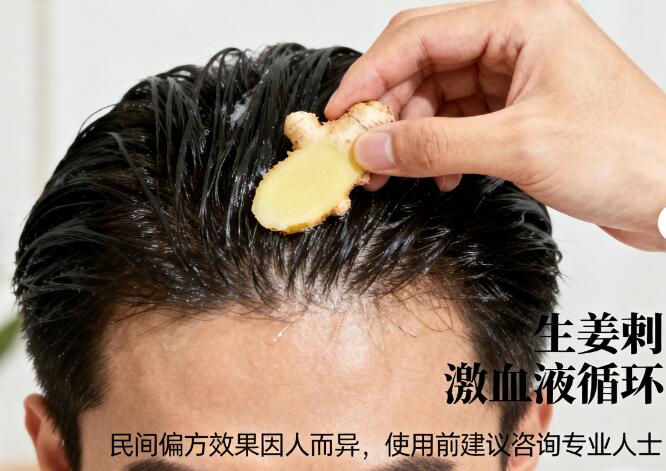 揭秘生发最快民间偏方:科学解析与实操指南,助你快速告别脱发困扰