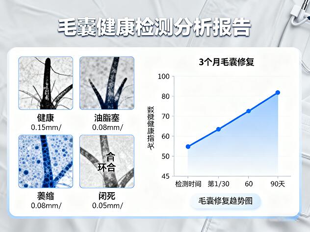 毛囊检测：揭秘脱发真相的关键钥匙？