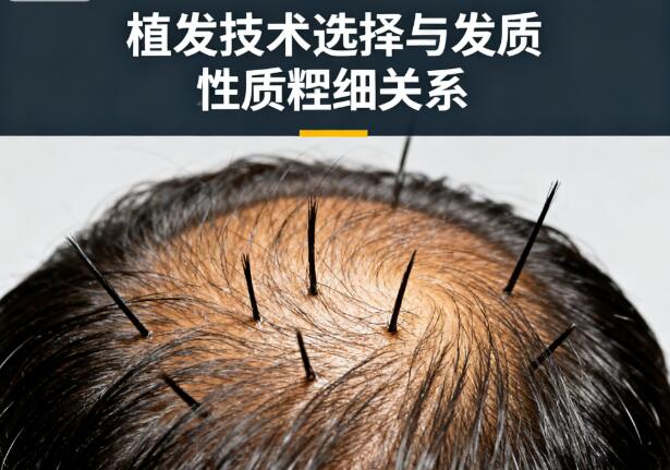 植发技术选择与发质粗细有关吗?细软发质适合哪种?