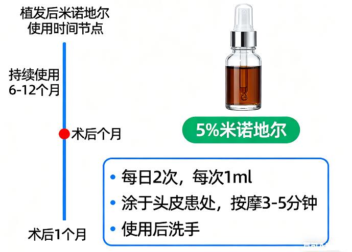 植发后米诺地尔使用黄金时间表:3大阶段+5大禁忌,科学用药不踩坑!