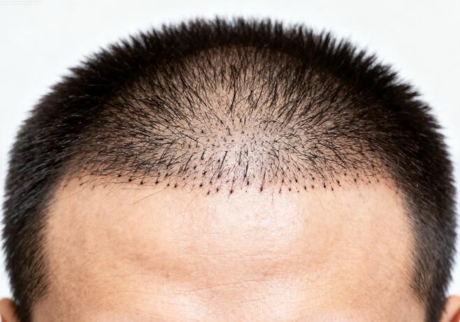 种植区与原生发衔接自然度:揭秘“无缝融合”的三大黄金法则