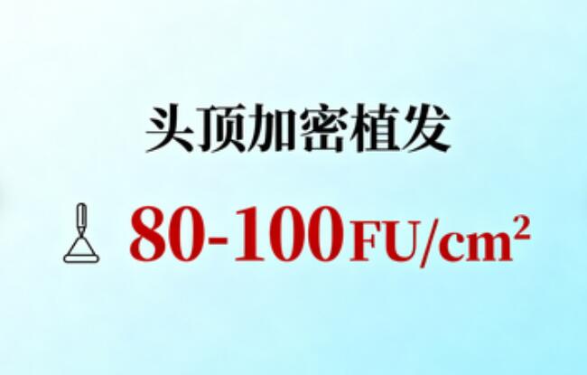 头顶加密植发80-100FU/cm²价格大起底:2.5万至4.5万如何选?