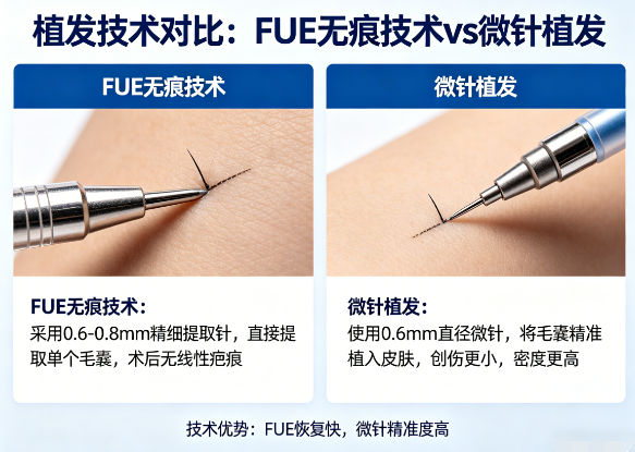 植发FUE无痕技术和微针植发到底有什么区别？一篇全看懂
