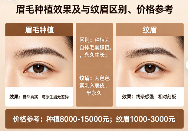 眉毛种植效果自然吗?和纹眉的区别以及价格参考