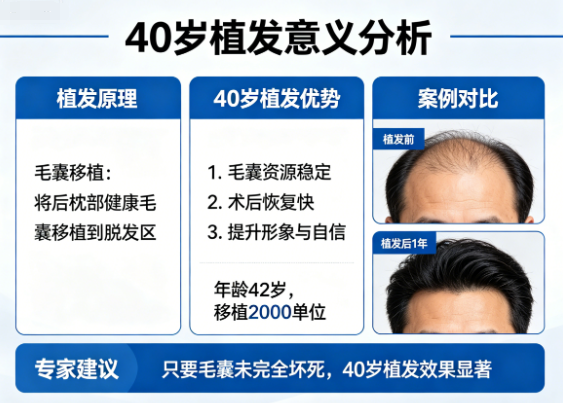 40岁植发还有意义吗