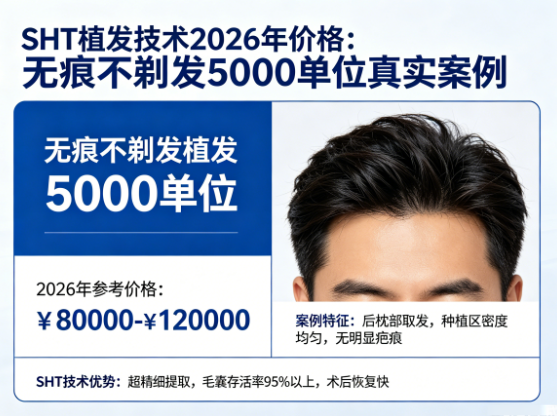 SHT植发技术2026年价格:无痕不剃发5000单位的真实案例