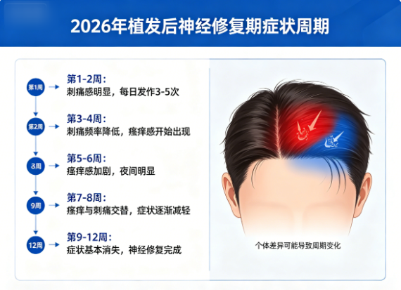 植发后感觉异常（刺痛/瘙痒）2026年神经修复期的症状周期