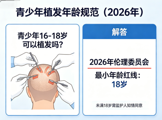 青少年16-18岁可以植发吗?2026年伦理委员会的最小年龄红线