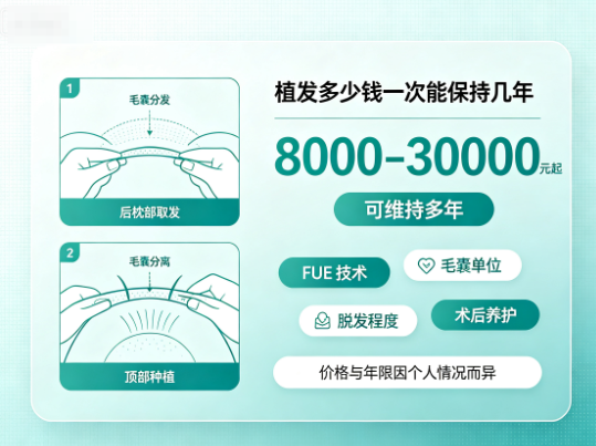 植发多少钱一次能保持几年
